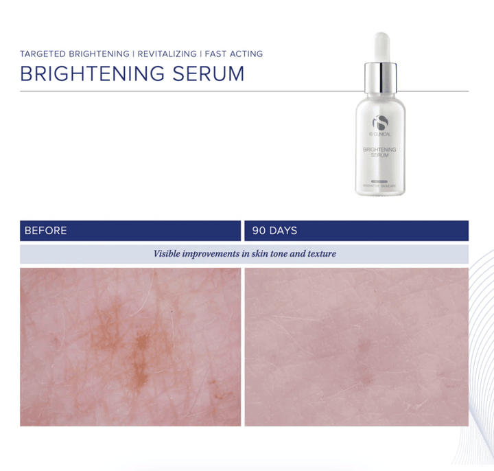 Brightening Serum