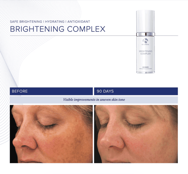 Brightening Complex