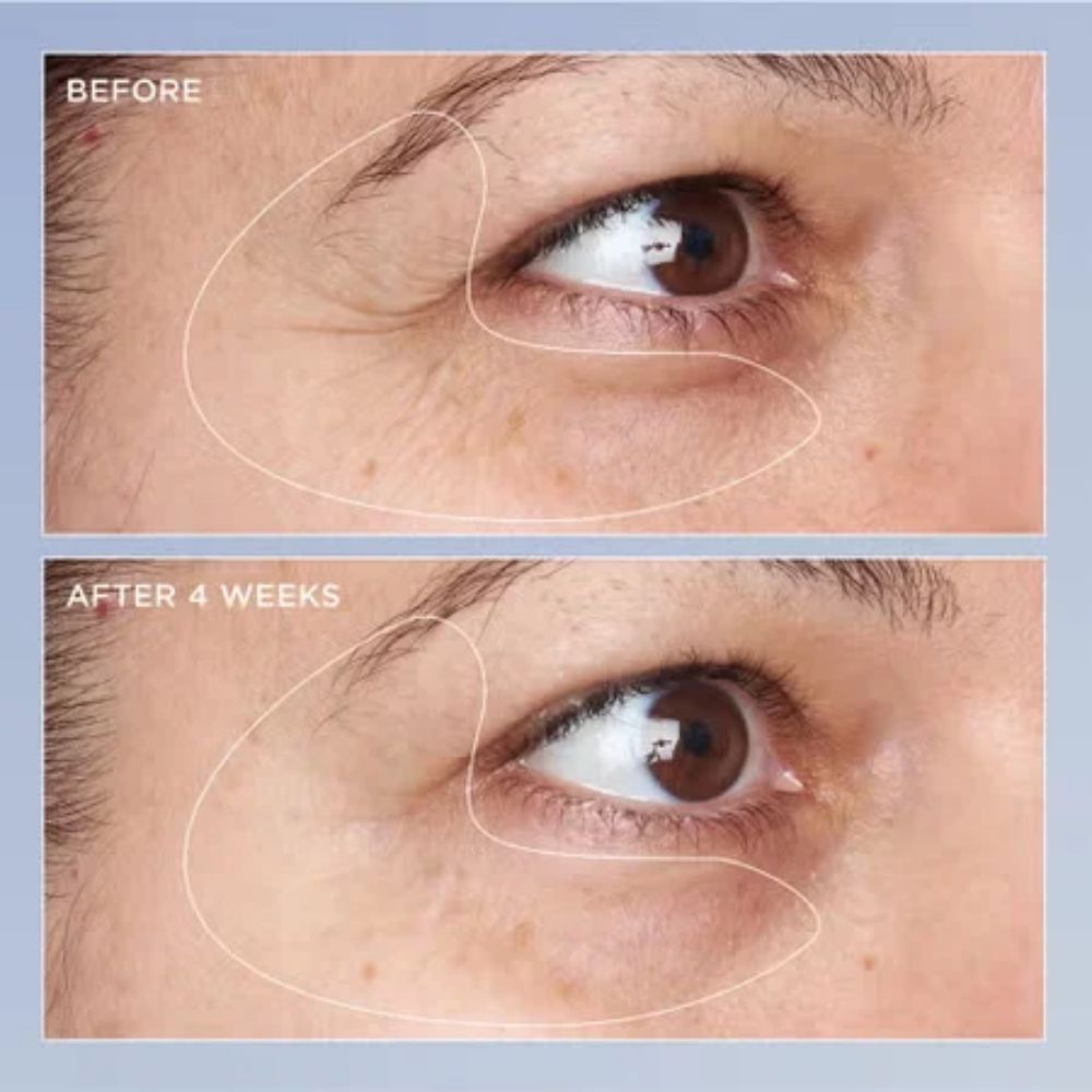 High Potency Triple Retinol Eye Recovery Serum