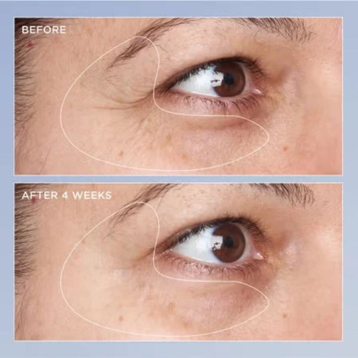 High Potency Triple Retinol Eye Recovery Serum