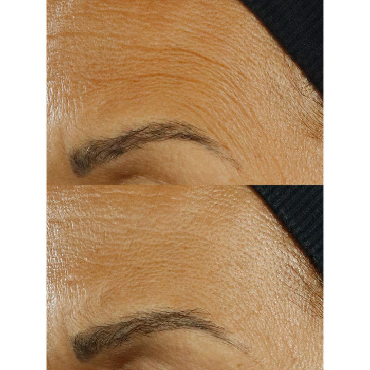 High Potency Triple Retinol Renewal Serum