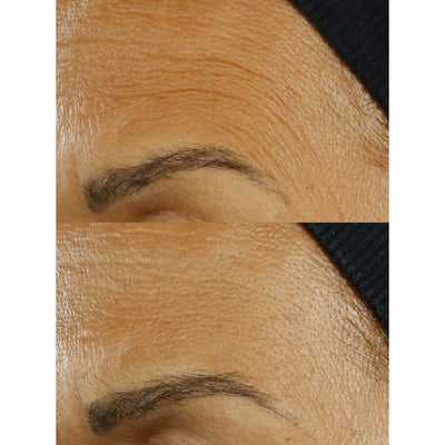 High Potency Triple Retinol Renewal Serum