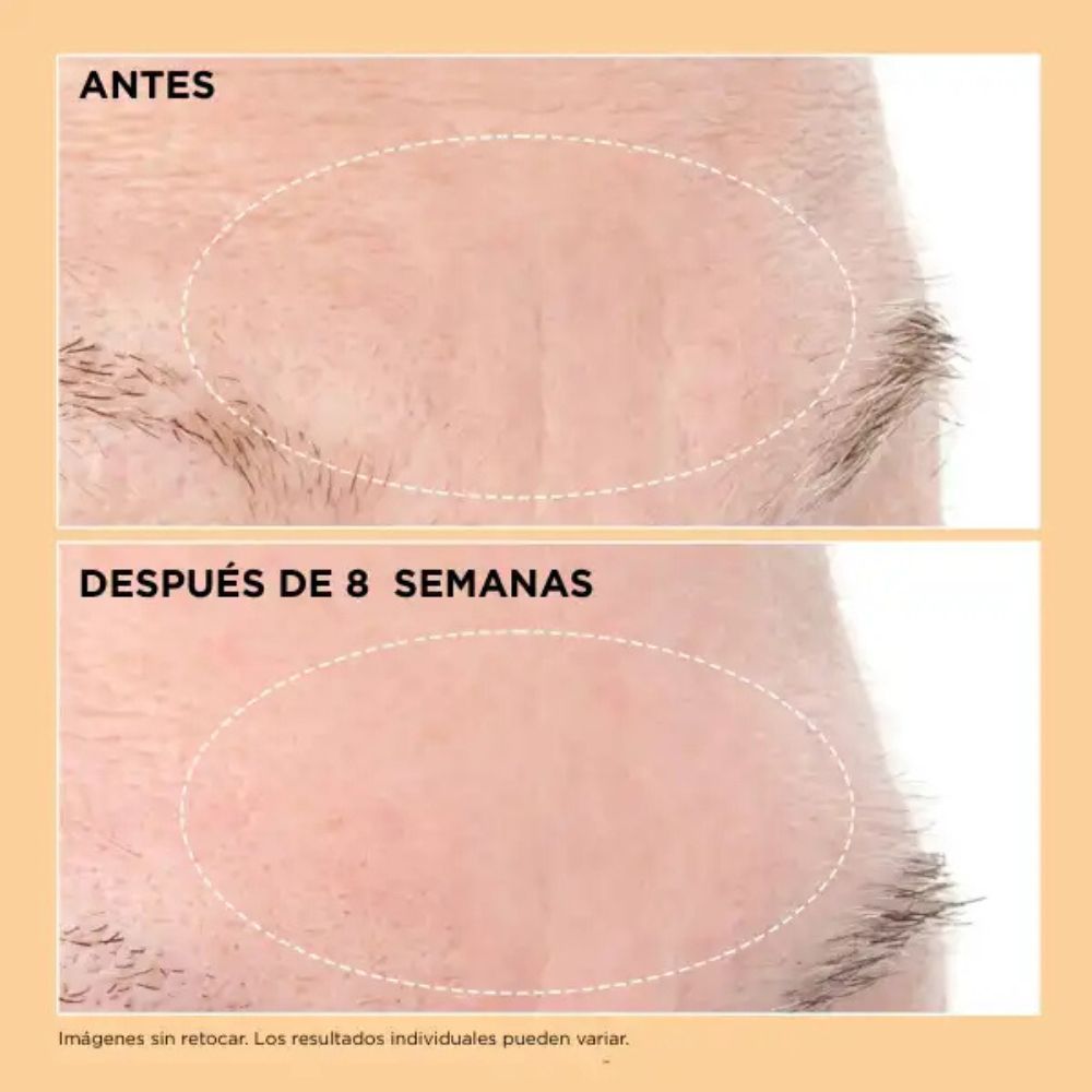 Neuropeptide Deep Crease Serum