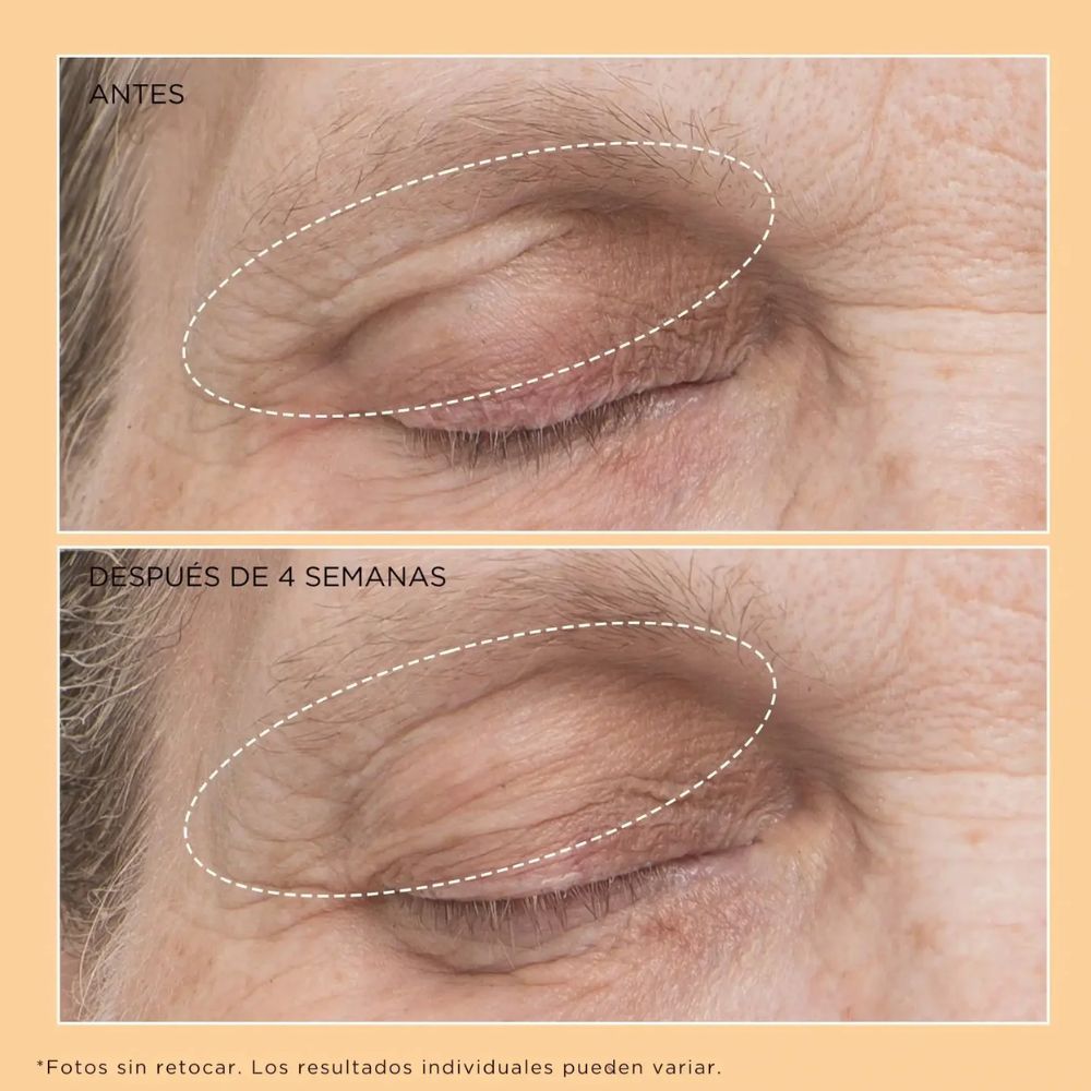 Neuropeptide Eyelid Lift Serum - Flacidez y Párpado caídos