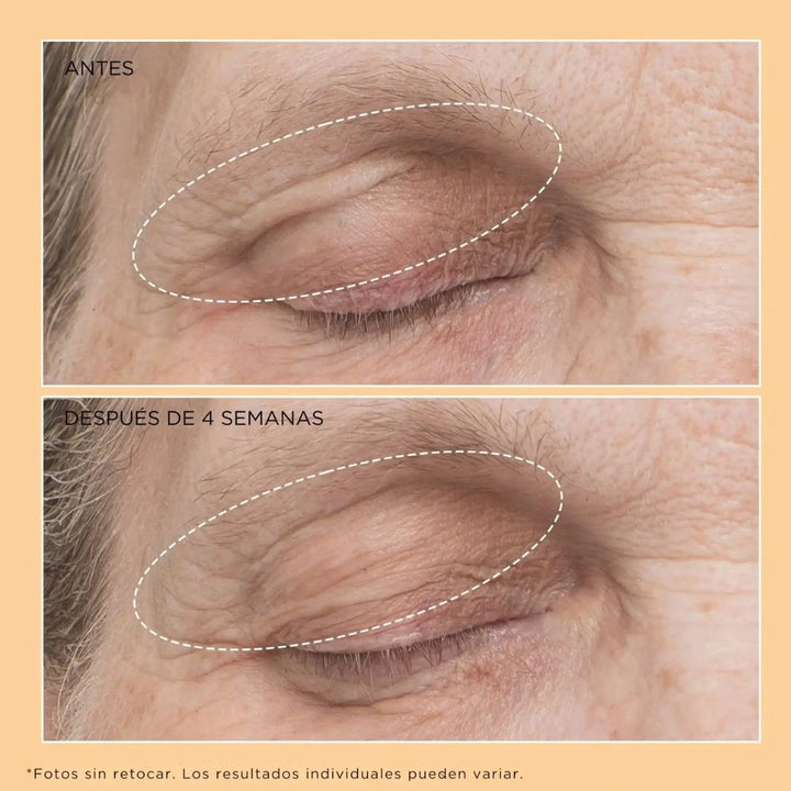 Neuropeptide Eyelid Lift Serum - Flacidez y Párpado caídos
