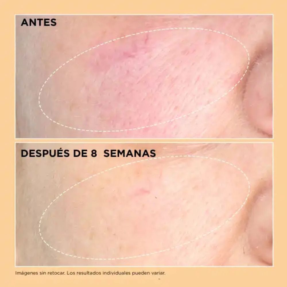 Neuropeptide Pro-Strength Firming Moisturizer