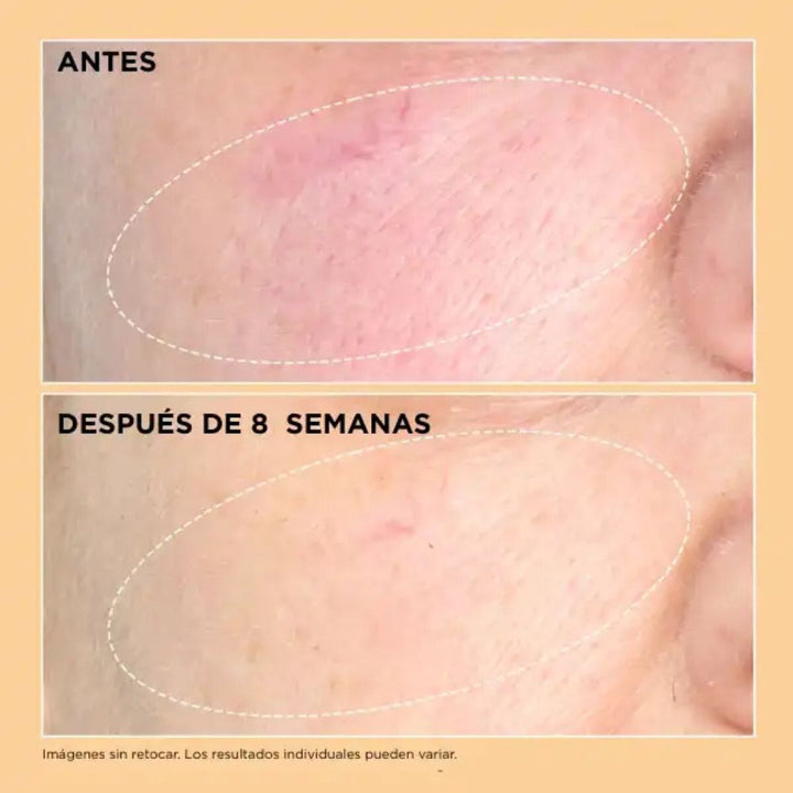 Neuropeptide Pro-Strength Firming Moisturizer