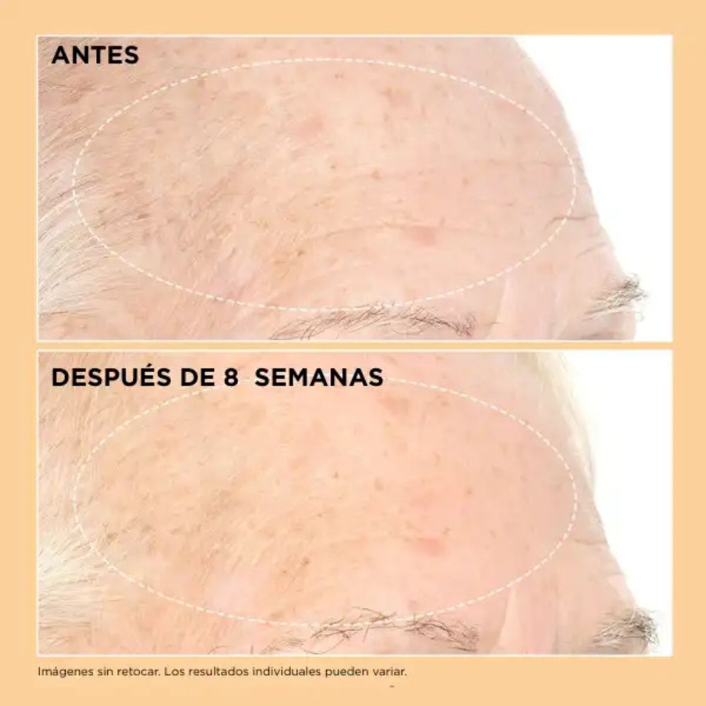 Neuropeptide Pro-Strength Firming Moisturizer
