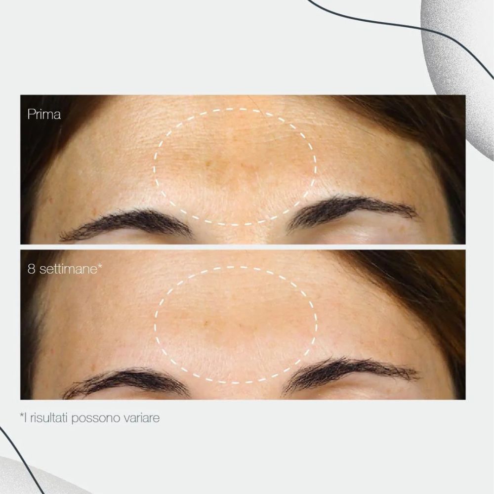 PowerBright Dark Spot Serum
